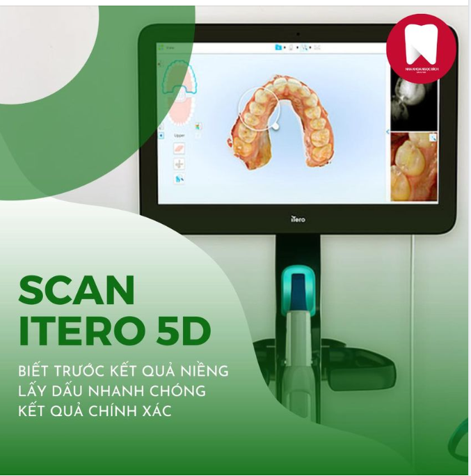 NIỀNG RĂNG BIẾT TRƯỚC KẾT QUẢ