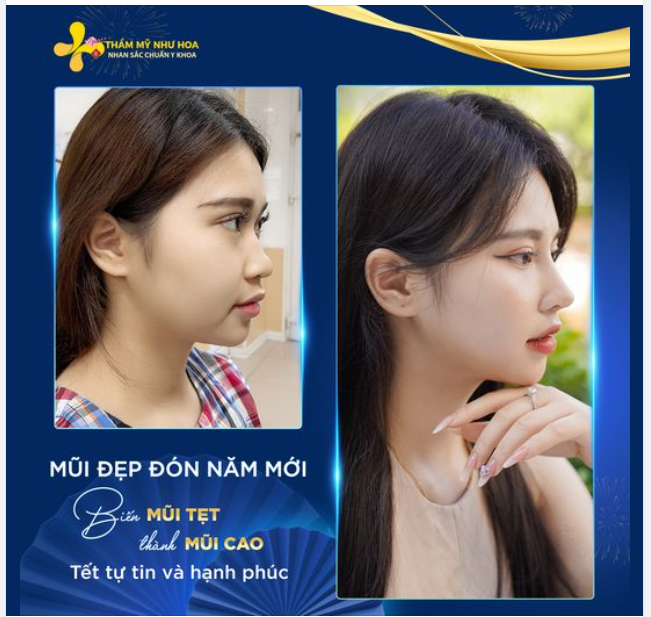 NẾU CỨ ĐẮN ĐO THÌ LẠI THÊM MỘT CÁI TẾT CHƯA XINH