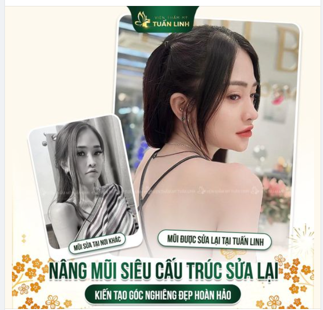 Một chiếc mũi đẹp hài hòa quan trọng như thế nào??