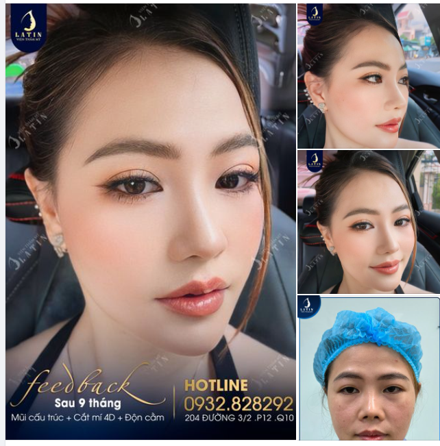 Tự tin với nhan sắc mới sau 9 tháng