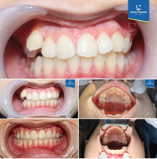 Khi thành công là tên gọi khác của sự kiên trì