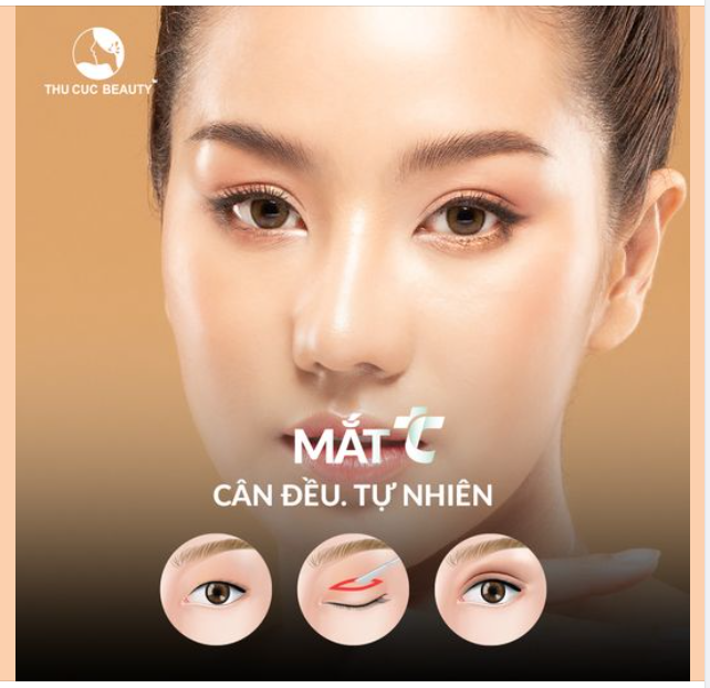 Khách hàng cắt mí cân đều, đẹp tự nhiên
