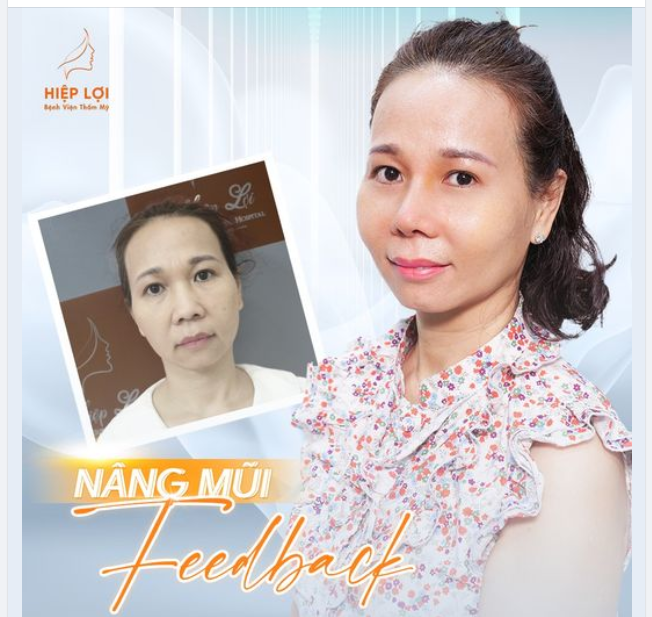 TIẾT KIỆM MÀ VẪN CÓ MŨI ĐẸP ĐÓN TẾT