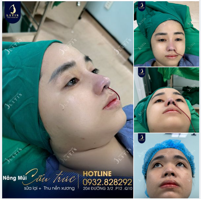 Thay đổi tích cực để bản thân hoàn thiện hơn