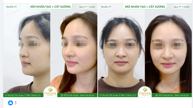 Đôi khi những thứ đơn giản nhất cũng có thể tạo ra hiệu quả tốt nhất cho một số trường hợp.