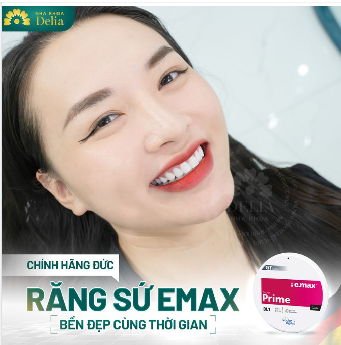 Chỉ sau 2 buổi hẹn bọc răng sứ cao cấp Emax, khách hàng sở hữu nụ cười khỏe mạnh, rạng rỡ!