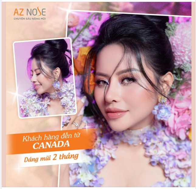 Dáng mũi Sline cao sắc sảo cho KH đến từ Canada