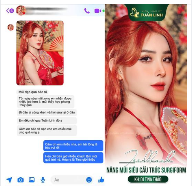 Feedback Nâng mũi Sang Xịn Mịn là đây!!