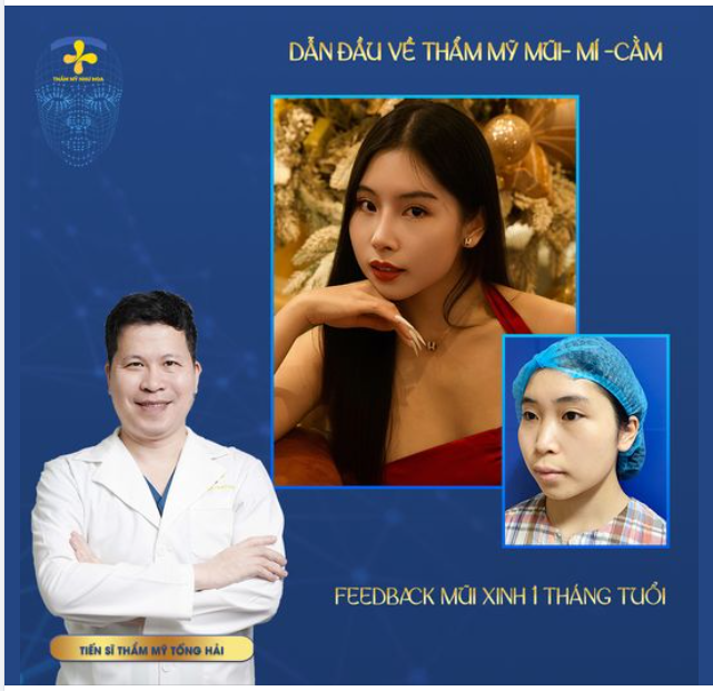 FEEDBACK MŨI XINH CỰC PHẨM SAU 1 THÁNG