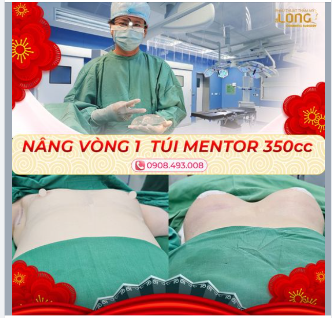 "Chào Xuân Với Sự Hoàn Hảo: Nâng Cấp Vòng 1 Để Tự Tin Rực Rỡ"