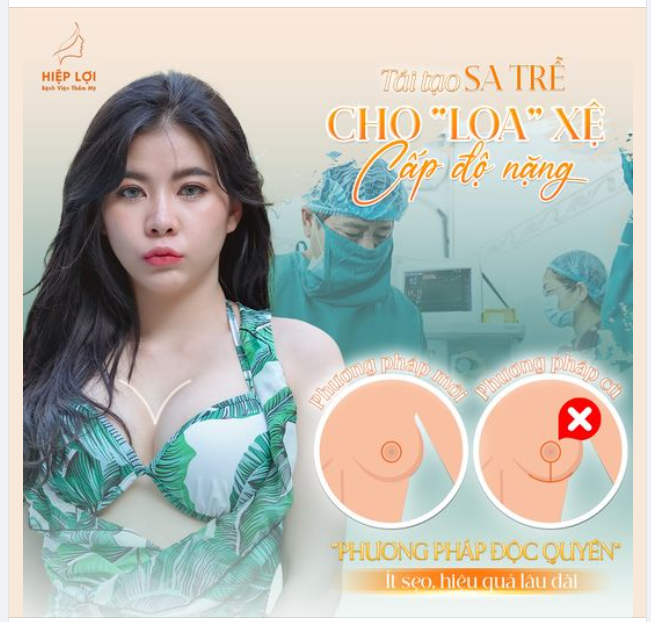LOA XỆ MỌI CẤP ĐỘ - AN TÂM TÁI TẠO VỚI PHƯƠNG PHÁP ĐỘC QUYỀN