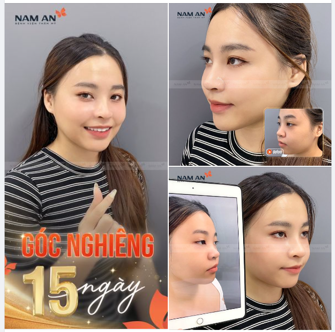THAY ĐỔI GÓC NGHIÊNG ĐÓN NĂM MỚI