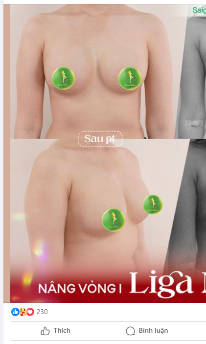 TĂNG SIZE V1, ĐỘT PHÁ ĐƯỜNG CONG