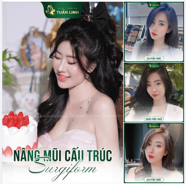 Mũi cao tôn lên góc nghiêng thần thánh cùng thần thái xinh đẹp sắc nét cho gương mặt!