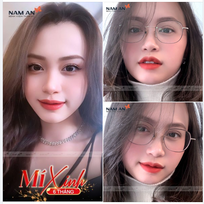 MÍ XINH LUNG LINH - TỰ TIN ĐÓN TẾT