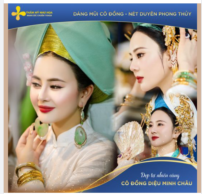 CÂU CHUYỆN NÂNG MŨI CỦA CÔ ĐỒNG DIỆU MINH CHÂU!