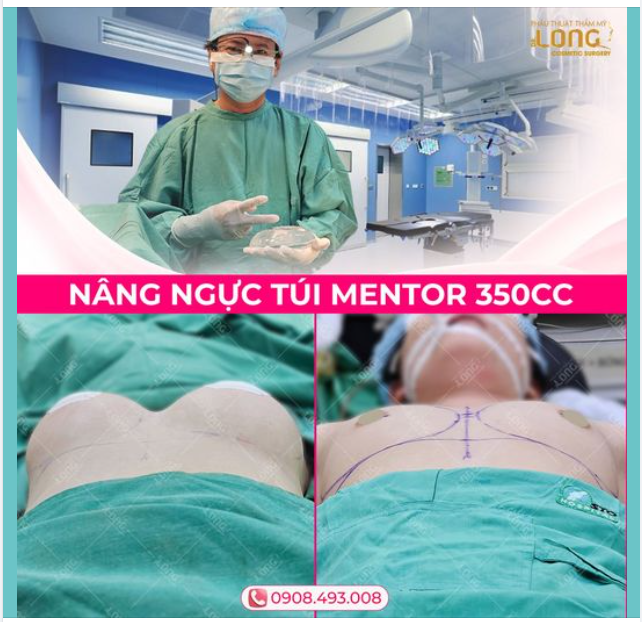 THAY ĐỔI LỚN TẠO NÊN ĐIỀU GÌ ???