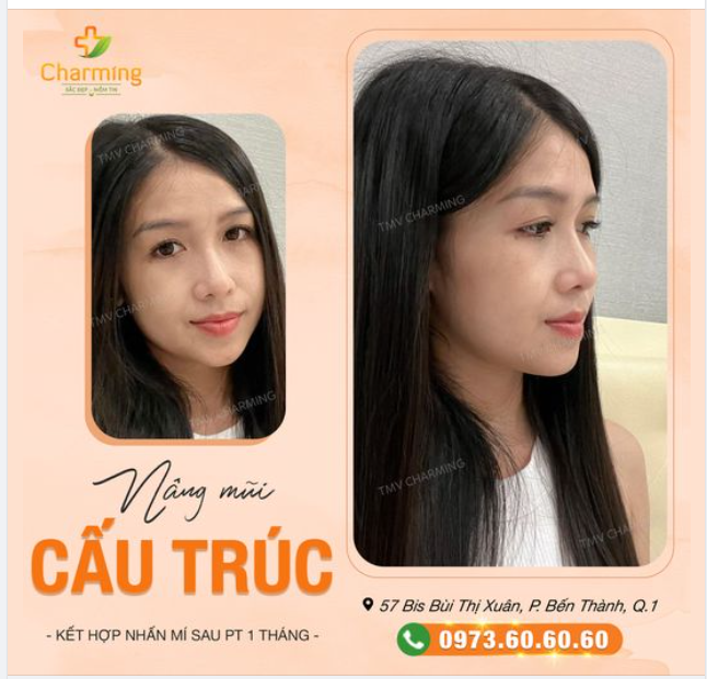 Mắt mũi của em cứ bị làm sao ấy... bị ĐẸP làm sao ấy