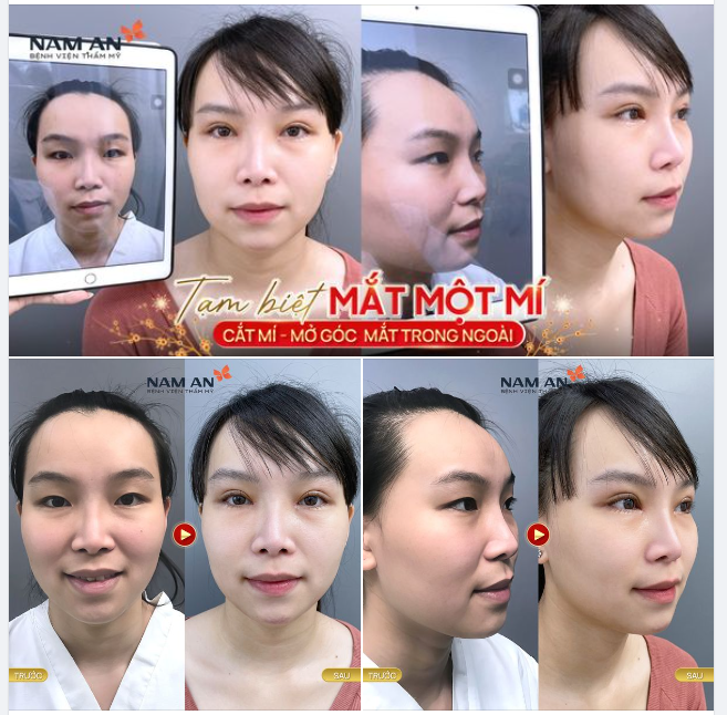 THAY ĐỔI ÁNH NHÌN - TỰ TIN TỎA SÁNG