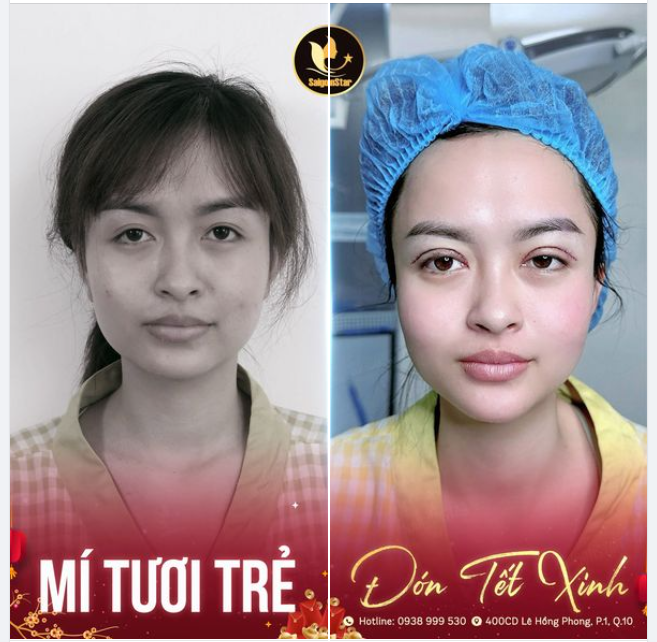 MÍ TƯƠI TRẺ - ĐÓN TẾT XINH