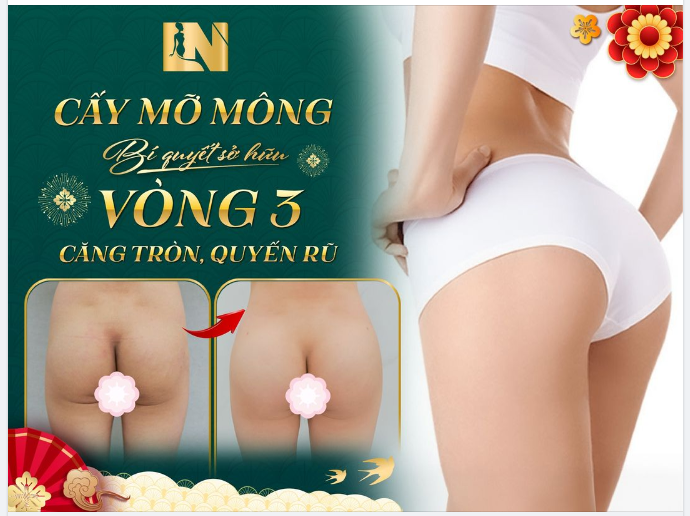 CẤY MỠ MÔNG, BÍ QUYẾT SỞ HỮU VÒNG 3 CĂNG TRÒN, QUYẾN RŨ