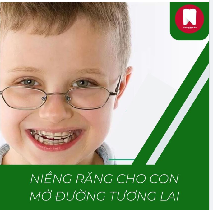 NIỀNG RĂNG CHO CON - MỞ ĐƯỜNG TƯƠNG LAI