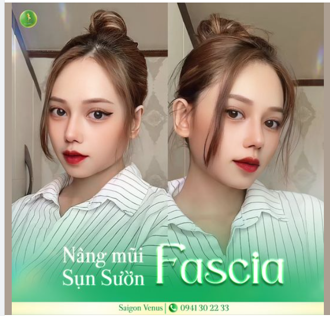 MŨI ĐẸP, BỀN NHỜ CÔNG NGHỆ SỤN SƯỜN FASCIA