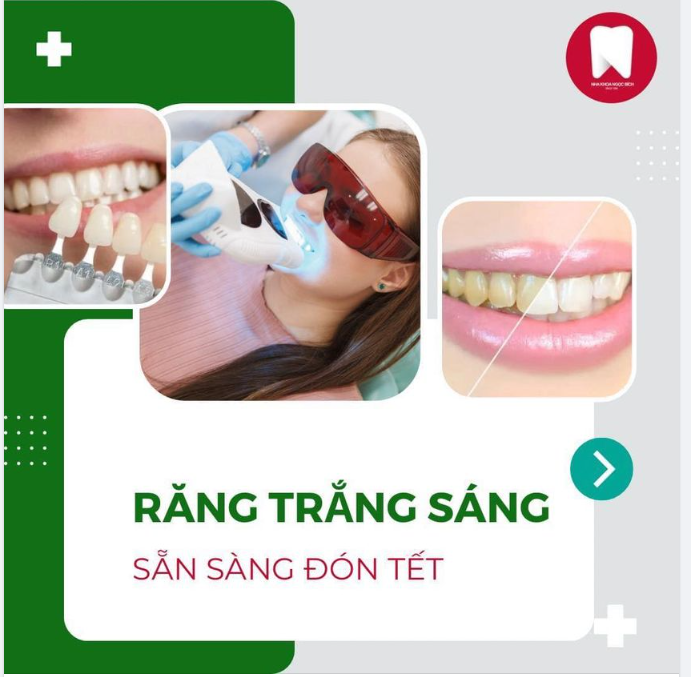 RĂNG TRẮNG SÁNG, SẴN SÀNG ĐÓN TẾT