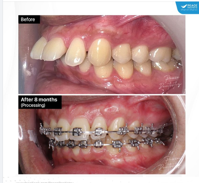 ORTHODONTICS PROCESSING