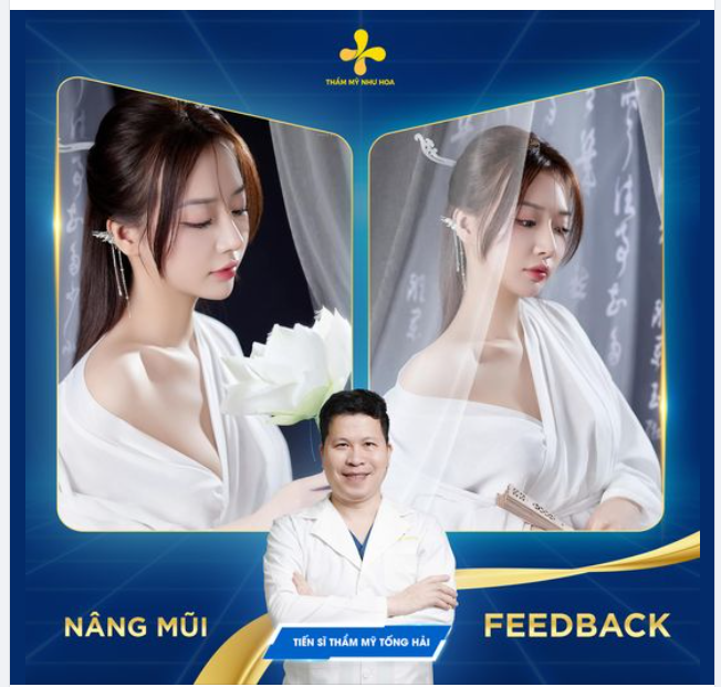 Đăng ảnh mũi đẹp cho chị em ngắm. Nếu thấy say đắm thì inbox luôn nào!