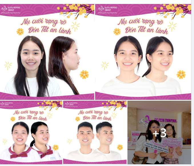 KHOE NỤ CƯỜI MỚI, ĐÓN VẠN NIỀM VUI