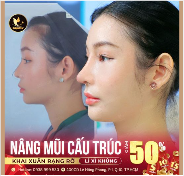 NÂNG MŨI CẤU TRÚC – KHAI XUÂN RẠNG RỠ