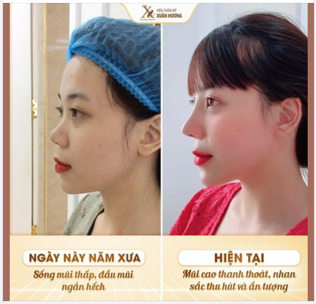 BẠN CÓ MỘT KỶ NIỆM CẦN XEM LẠI