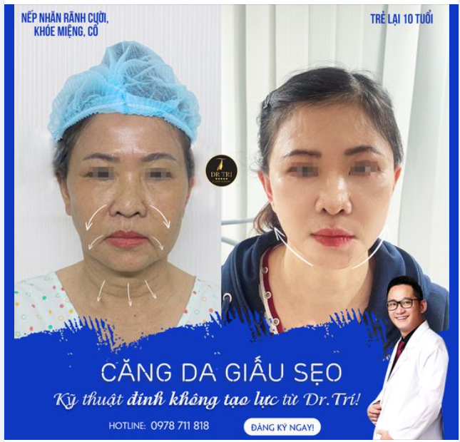 TRẺ LẠI 10 TUỔI CHỈ SAU 7 NGÀY!!