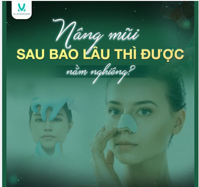 NÂNG MŨI BAO LÂU THÌ ĐƯỢC NẰM NGHIÊNG