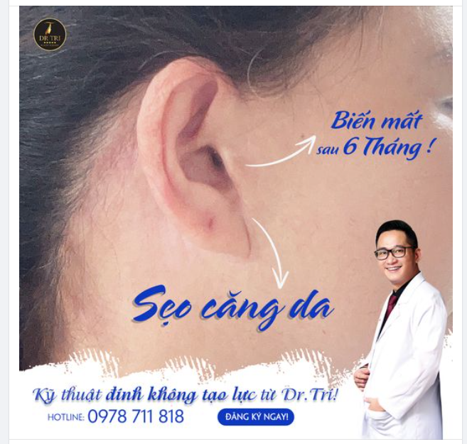 Đừng ngại thay đổi để trở nên trẻ đẹp​​​​​​​ Với CĂNG DA GIẤU SẸO ĐỘC QUYỀN DR.TRÍ