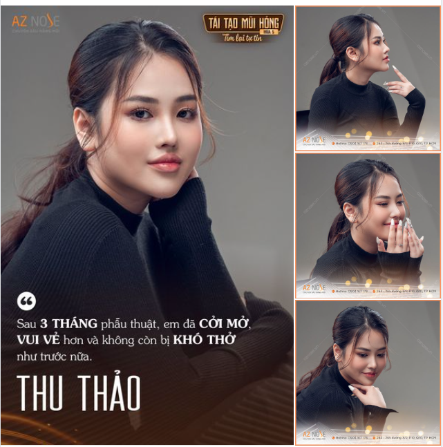 Từ dáng mũi bị trêu là “đột biến” đến Sline thanh tú sau 3 tháng