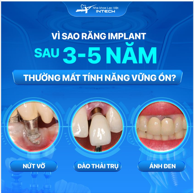 VÌ SAO RĂNG IMPLANT SAU 3-5 NĂM SỬ DỤNG THƯỜNG MẤT TÍNH VỮNG ỔN?