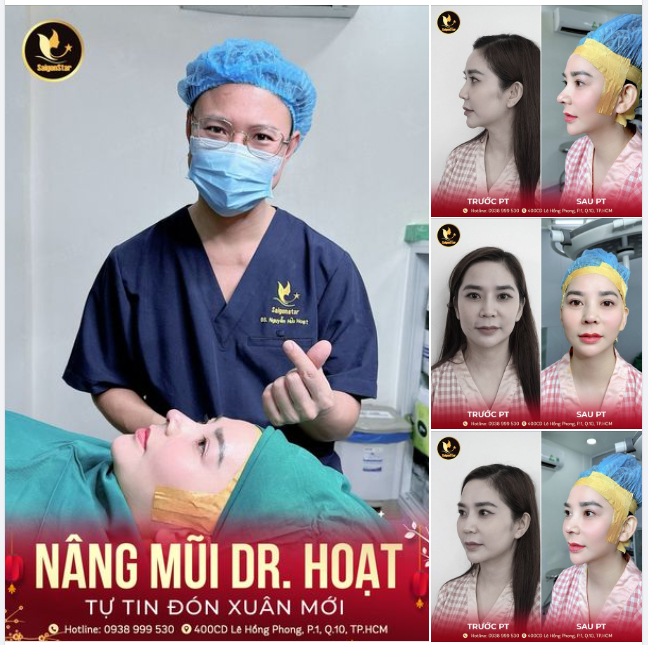 NÂNG MŨI DR. HOẠT – TỰ TIN ĐÓN XUÂN MỚI