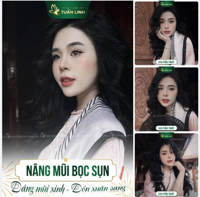 Tết này xinh rạng ngời cùng chiếc mũi bọc sụn cao đẹp tự nhiên!!