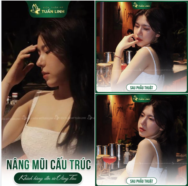 Cô nàng genZ đến từ Vũng Tàu khoe nhan sắc ngọt ngào cùng dáng mũi siêu xinh!!