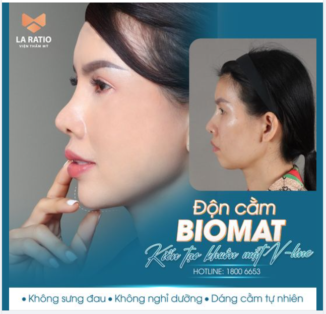 Độn cằm là phương pháp giải quyết mọi khuyết điểm: Cằm ngắn, cằm lẹm, cằm lệch thiếu cân đối