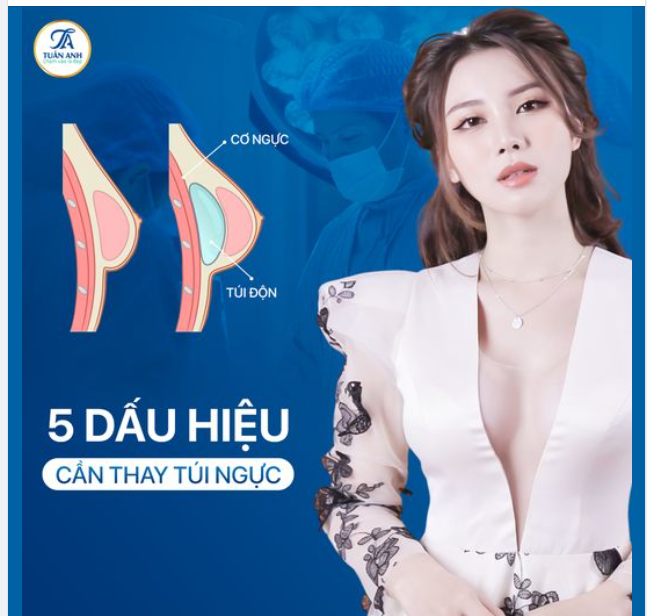 5 DẤU HIỆN CẦN THAY TÚI NGỰC