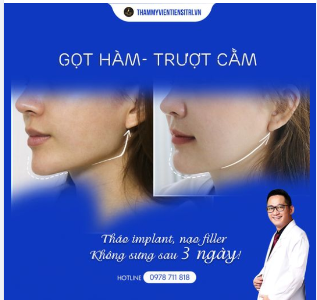 Độ mát tay của Dr.trí thế nào