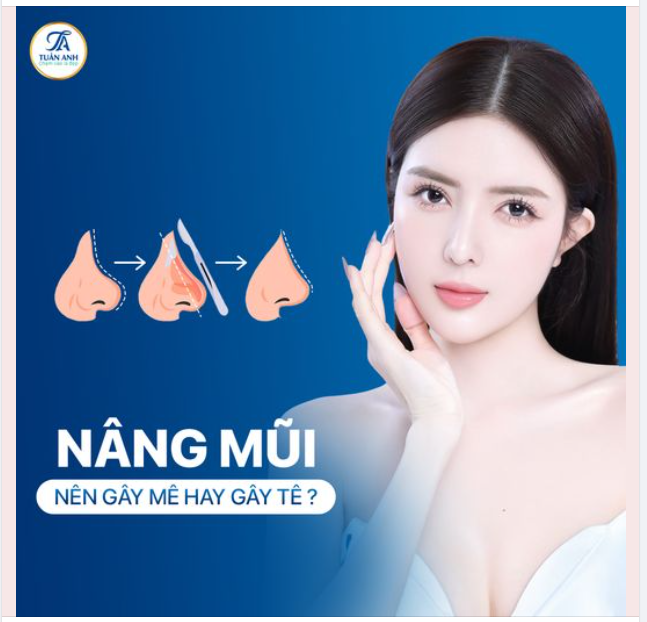 KHI NÂNG MŨI NÊN CHỌN GÂY MÊ HAY GÂY TÊ?