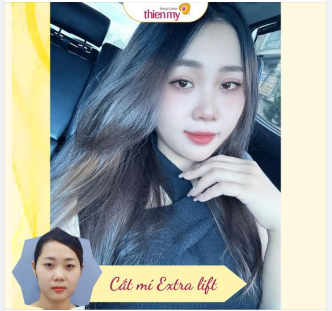 FEEDBACK xịn xò nhà Thiện Mỹ.