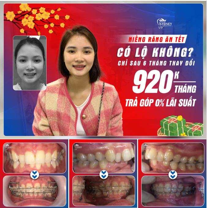 MẮC CÀI PHA LÊ – TỰ TIN ĂN TẾT KHÔNG SỢ LỘ