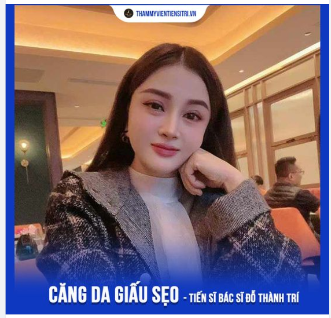 Tin tưởng kinh nghiệm và độ mát tay của Dr.Trí Sau 1 năm CĂNG DA GIẤU SẸO nhan sắc chị đẹp thăng hạng