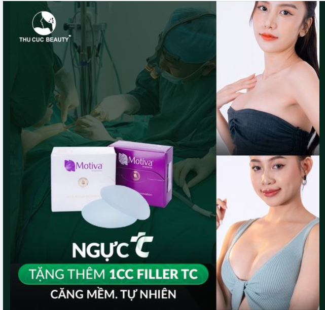 V1 teo lép hóa căng tròn sau 60P với Motive