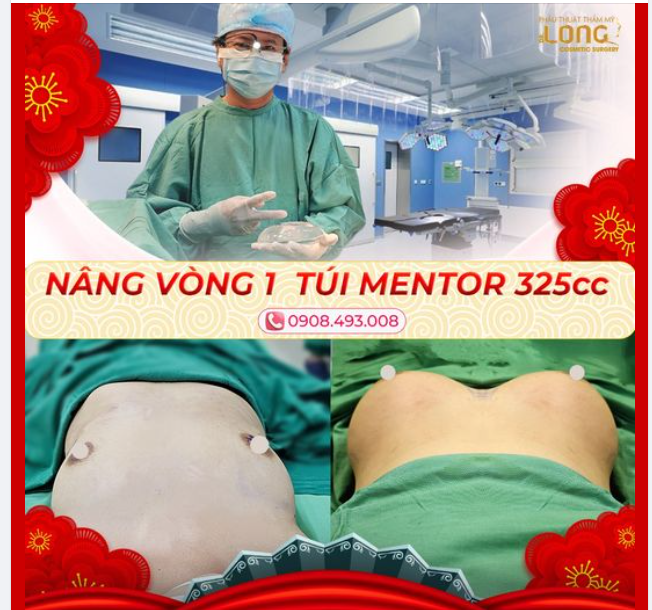 THÊM MỘT CẶP ANH ĐÀO LAN TỎA HƯƠNG VỊ XUÂN MỚI